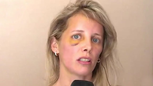Una mujer fue golpeada brutalmente en plena calle | Actualidad