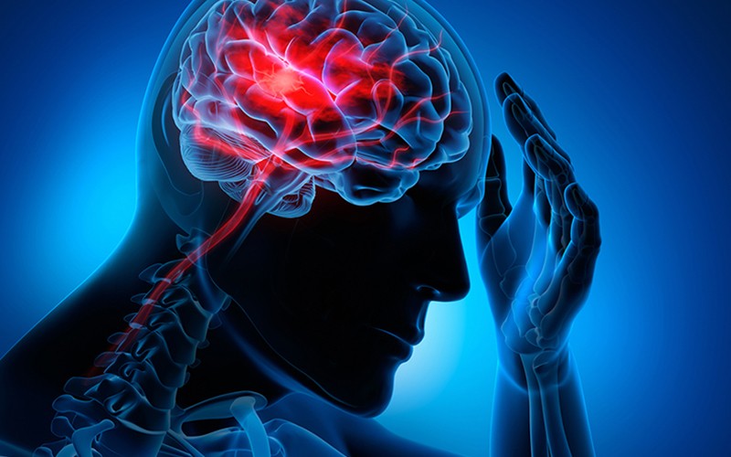 ¿Cómo prevenir un ACV? | Salud