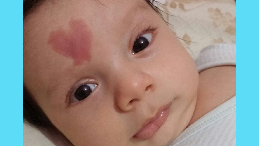 ¡Sorprendente! Mirá al bebé que tiene en la frente una mancha con forma de corazón | Virales