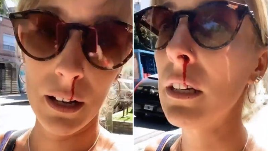 Violento intento de robo a Dani la Chepi | Influencers