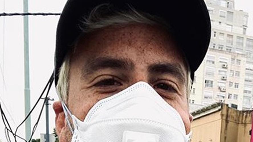 Fede Bal compartió con sus seguidores su primera sesión de rayos | Espectáculos