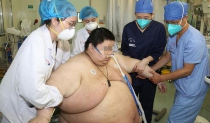 El insólito caso del hombre que aumentó 100 kilos durante la cuarentena | En el mundo