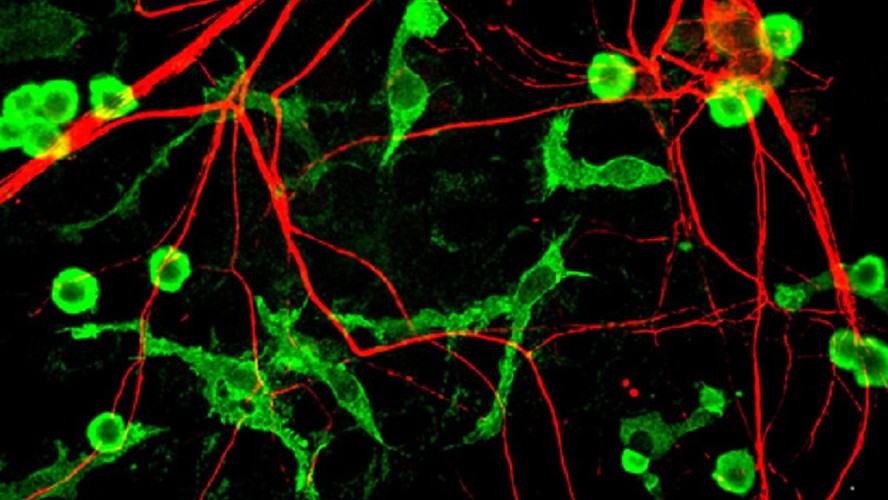 El impactante video que muestra cómo un cerebro destruye las neuronas muertas | Salud