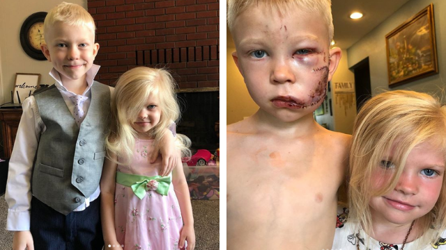 “Si alguien debía morir, tenía que ser yo”: El niño que salvó a su hermana del ataque de un perro | Virales