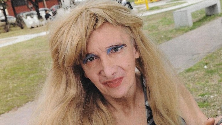 Tras el violento ataque, Zulma Lobato recibió la ayuda de un reconocido abogado | Sociedad