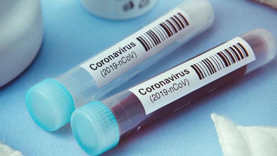 Determinan que tipo de sangre es más resiste al coronavirus | En el mundo