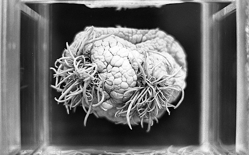 Le dolía la cabeza y descubrieron que tenía larvas en el cerebro | Curiosidades