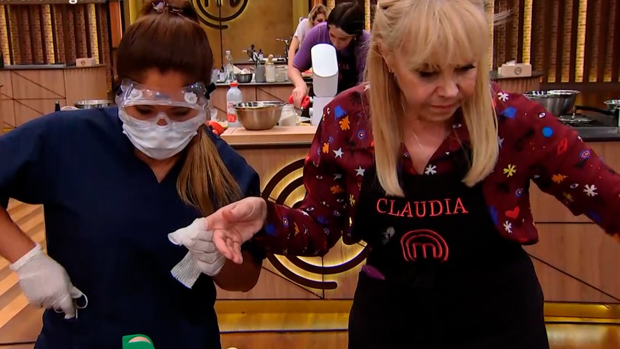 La durísima quemadura que sufrió Claudia Villafañe | Exclusivos