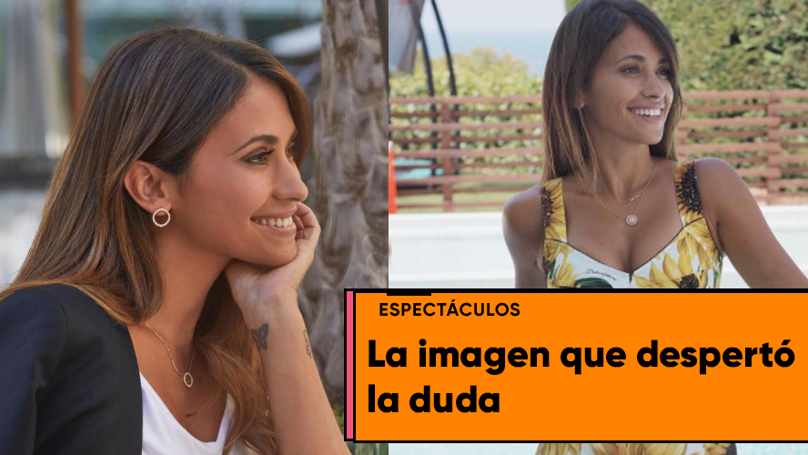 En las redes creen que Antonela Rocuzzo se hizo un retoque facial | Espectáculos
