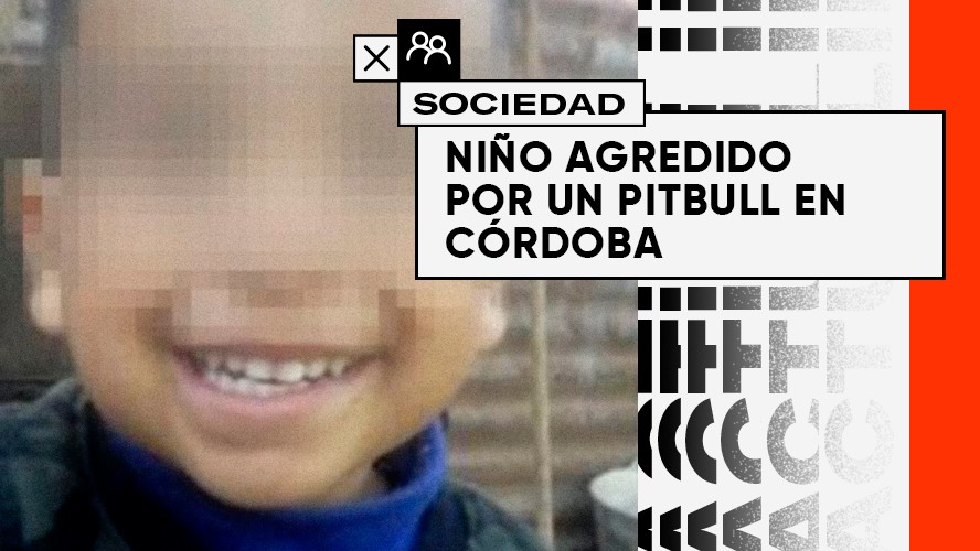 Polémica en Córdoba: un niño fue atacado por un pitbull | Sociedad