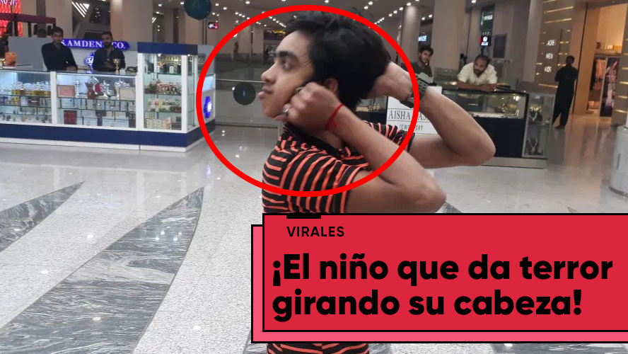 ¡Imágenes sensibles! Un adolescente de 14 años puede girar 180 grados su cabeza | Virales