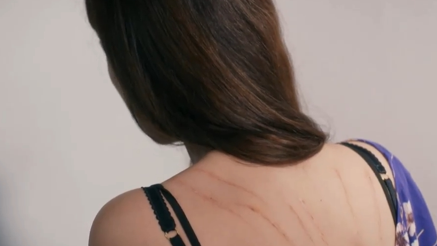 Los golpes que sufrió Nefes, una vez más al descubierto | Mejores Momentos