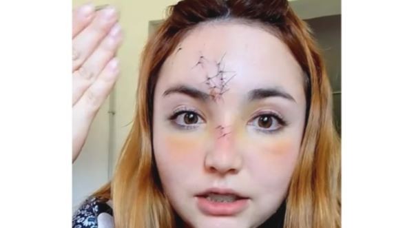 Una joven recibió un botellazo en el boliche: le tuvieron que coser la cara | Sociedad