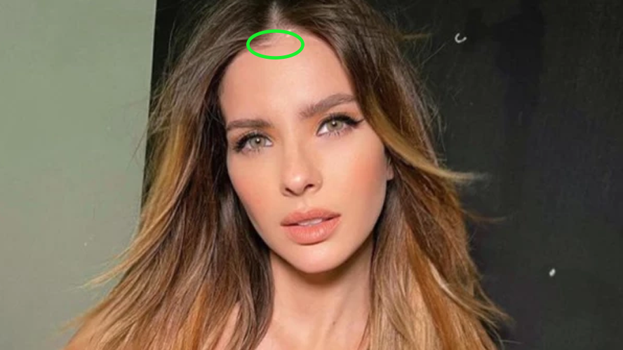 La llamativa cicatriz de la China Suárez | Espectáculos