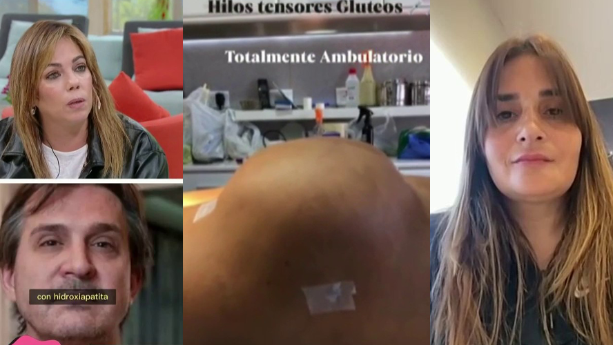 Otra víctima de Lotocki habló por primera vez: hilos tensores con tanza y operaciones ambulatorias con irregularidades | Mejores Momentos