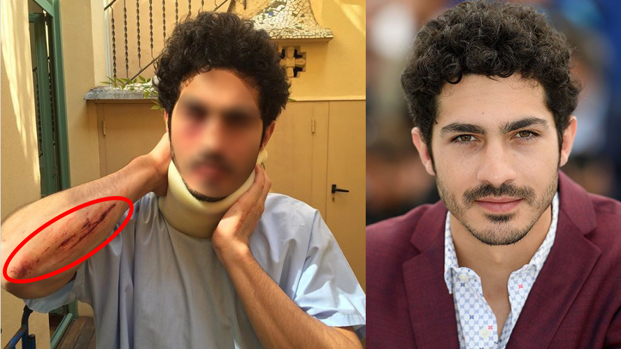 ¿Qué le pasó? Impactantes fotos de el Chino Darín | Espectáculos