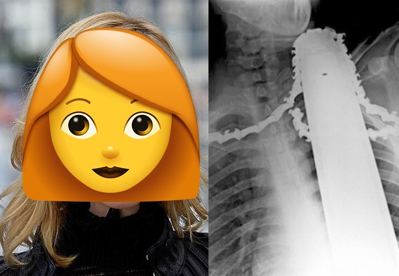 ¡Famosa actriz tuvo un duro accidente con la motosierra y casi no la cuenta! | Espectáculos