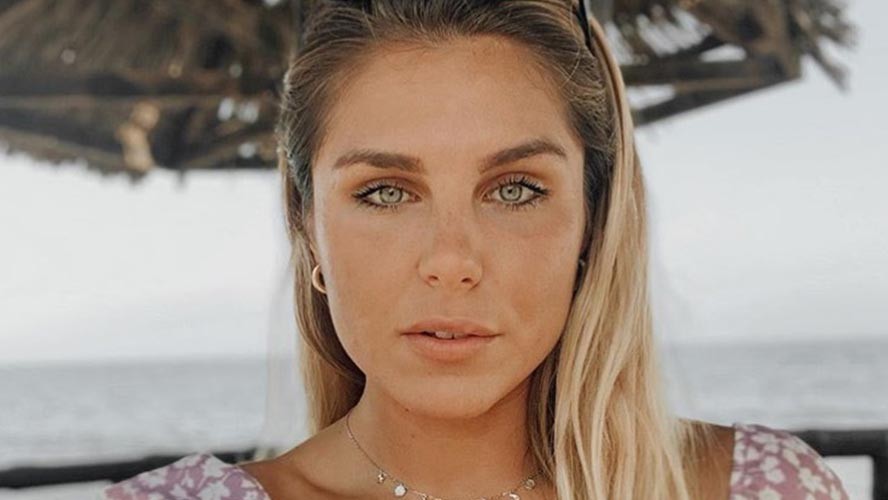 Ivana Icardi tuvo un imprevisto y amaneció con la cara deformada | Espectáculos