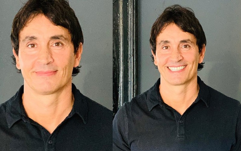 Sebastián Estevanez mostró cómo le quedó su rostro luego de sufrir un accidente doméstico | Espectáculos