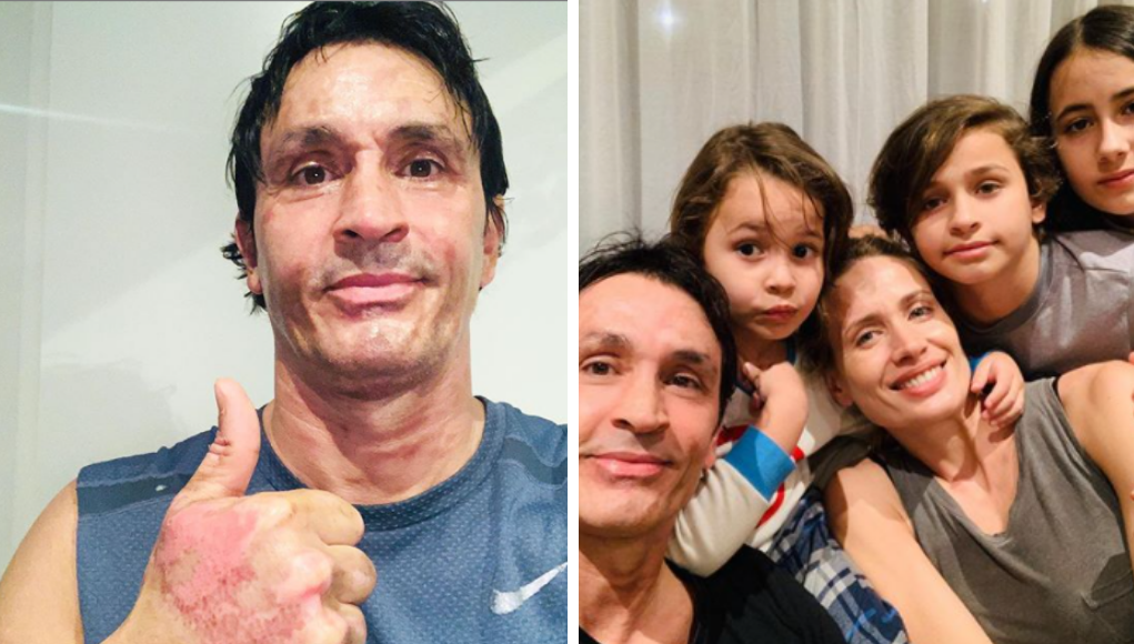 A dos meses del accidente Sebastián Estevanez muestra su recuperación | Espectáculos