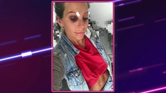 Noelia Marzol hizo un show en vivo, ¡y salió mal!