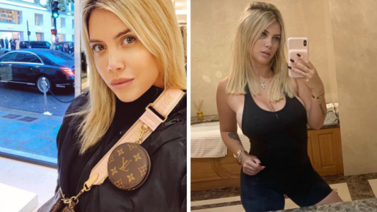 Wanda Nara confirmó que no tiene ninguna cirugía estética