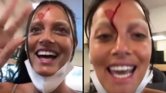 Oriana Sabatini sufrió sangriento accidente gimnasio