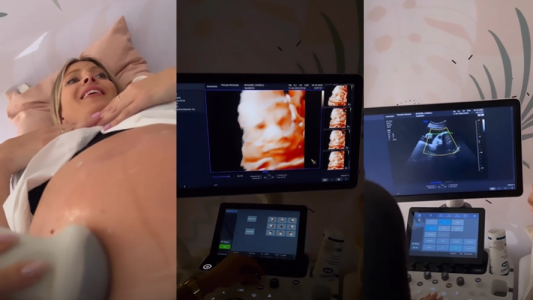 Cande Ruggeri unió a toda su familia para que presenciaran su ecografía 5D