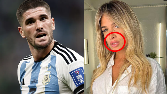 Camila Homs se hizo un retoque estético y la criticaron en las redes