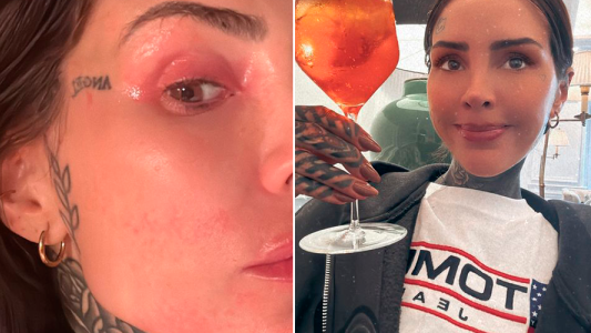 Cande Tinelli atendida urgencia hospital España culpa fármaco