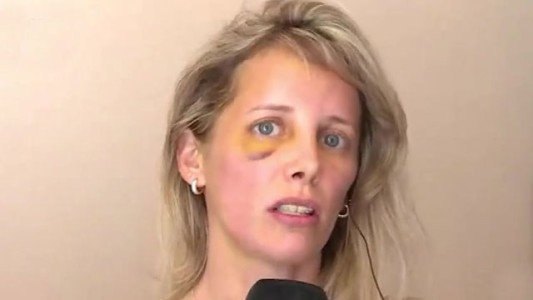 Una mujer fue golpeada brutalmente en plena calle