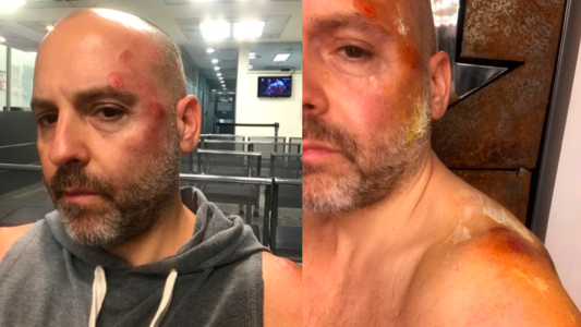 José María Muscari tuvo un accidente vial