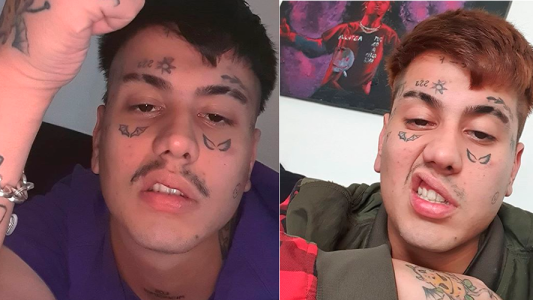 Duki tuvo que ser atendido de urgencia