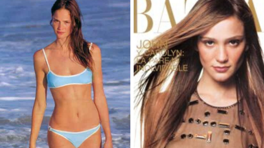 Fue una super modelo en los 90 y ahora padece una terrible enfermedad