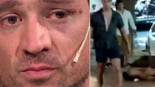 Chano habló sobre el caso Fernando Báez Sosa: "Me hizo acordar cuando me tapaba de las patadas que me daban"