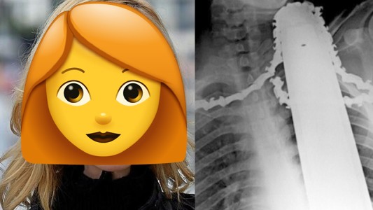 ¡Famosa actriz tuvo un duro accidente con la motosierra y casi no la cuenta!