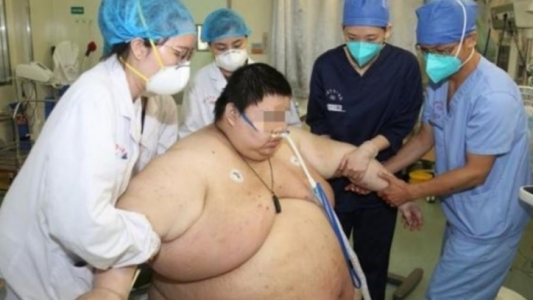 El insólito caso del hombre que aumentó 100 kilos durante la cuarentena