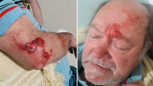 Rompió el silencio el jubilado que fue asaltado y mató a un ladrón