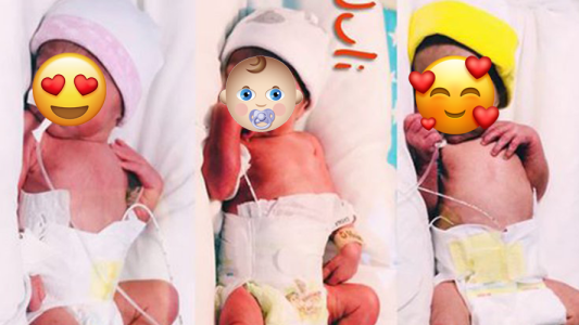 Caso inusual: nacieron trigemelas en Argentina