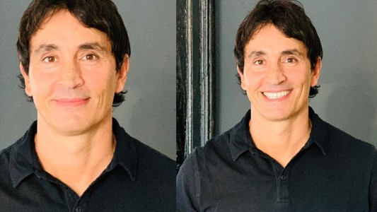 Sebastián Estevanez mostró cómo le quedó su rostro luego de sufrir un accidente doméstico