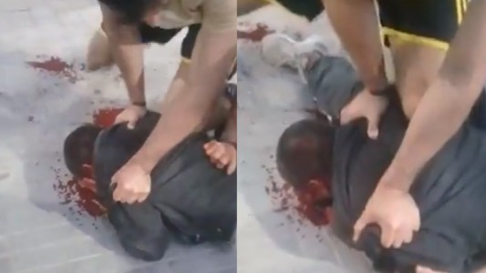 Intentó robarle a una embarazada, lo agarraron los vecinos y se vengaron