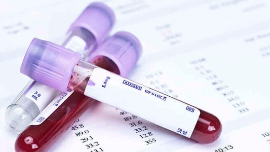 Un test dectectaría el cáncer anticipadamente