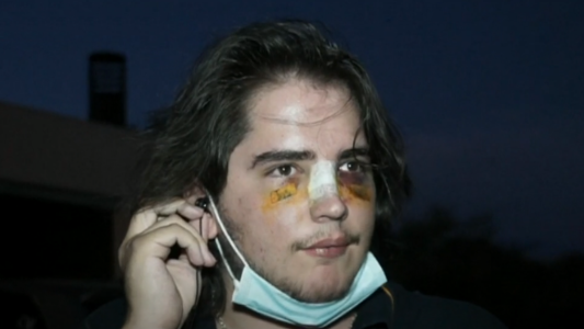 Un grupo de rugbiers golpeó a un joven de 18 años