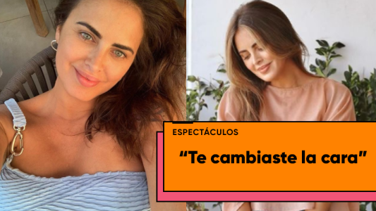 Silvina Luna publicó una foto y sus fans creen que se hizo un retoque facial