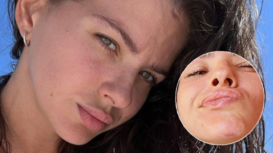 China Suárez sufrió doloroso accidente pileta: "Me olvidé de abrir los ojos"