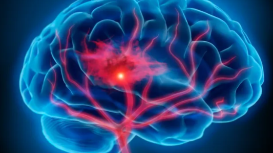 Qué es la afasia, la enfermedad que padece Bruce Willis