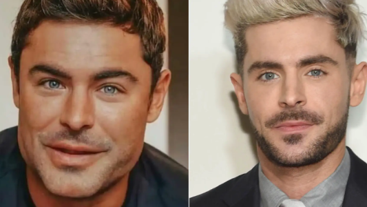 Zac Efron y su cambio físico: el actor puso fin a los rumores y explicó lo que sucedió