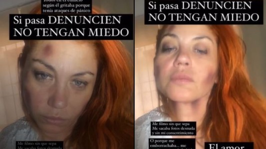 Lowrdes, la ex "Bandana", denunció ser víctima de violencia de género