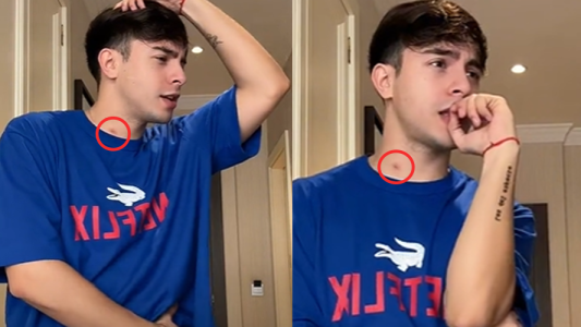 Rusherking challenge Maria Becerra chupon cuello mosquito