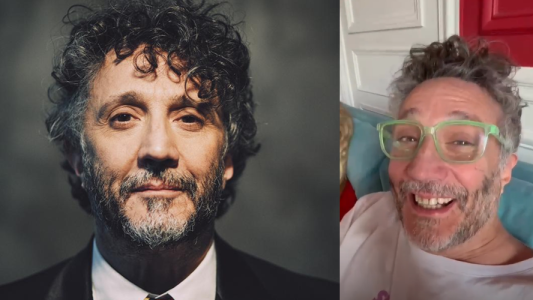 Fito Páez habló de su estado de salud: ¡la verdad sobre su operación!